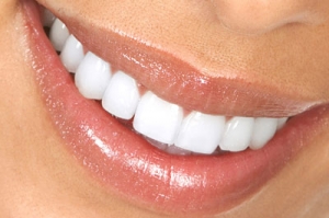 surgically-assisted-orthodontics-tulsa